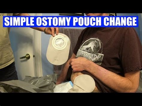 Removes or cuts the bottom of the bag and. . Can a cna change a colostomy bag in florida